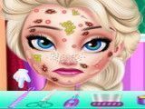 Cuidar do rosto da Elsa princesa